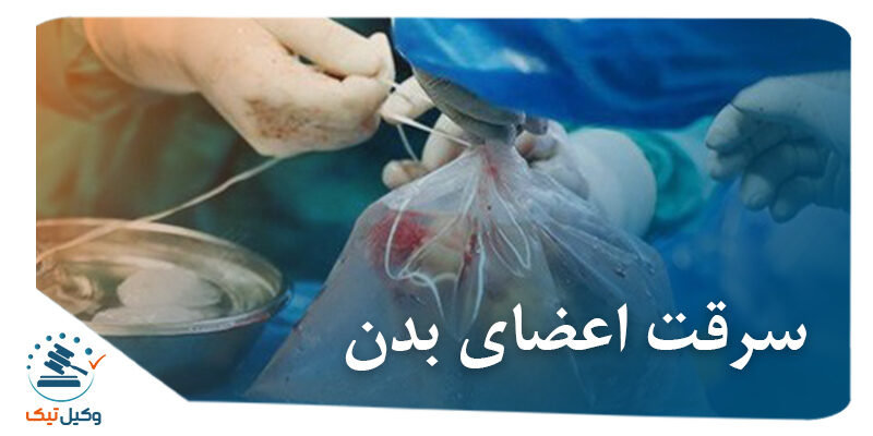 سرقت اعضای بدن سرقت اعضای بدن